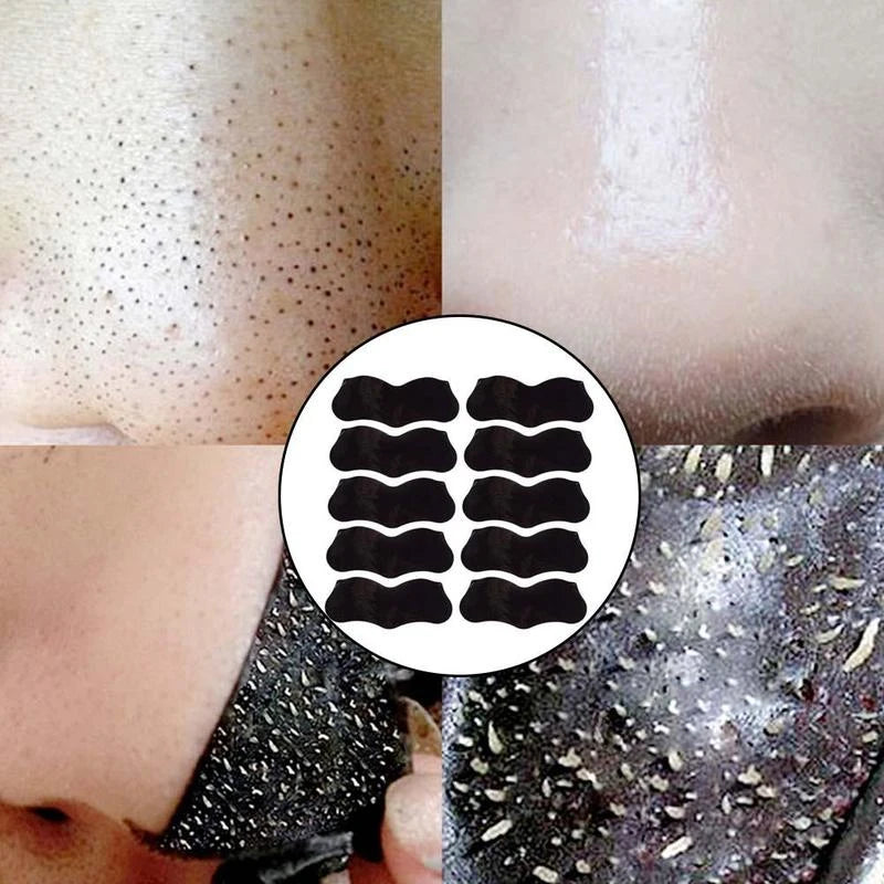 5pcs Blackhead Nasal Patch Remove Acne Suck Blackheads Deep Cleansing Shrink Pores Tear And Pull The Mask To Remove Blackheads
