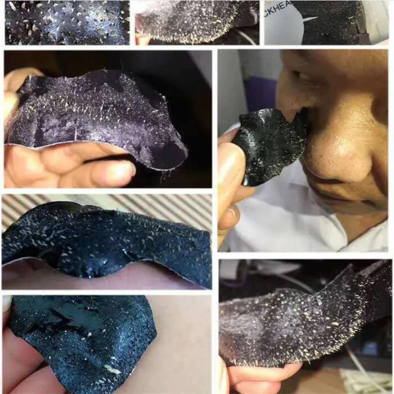 5pcs Blackhead Nasal Patch Remove Acne Suck Blackheads Deep Cleansing Shrink Pores Tear And Pull The Mask To Remove Blackheads