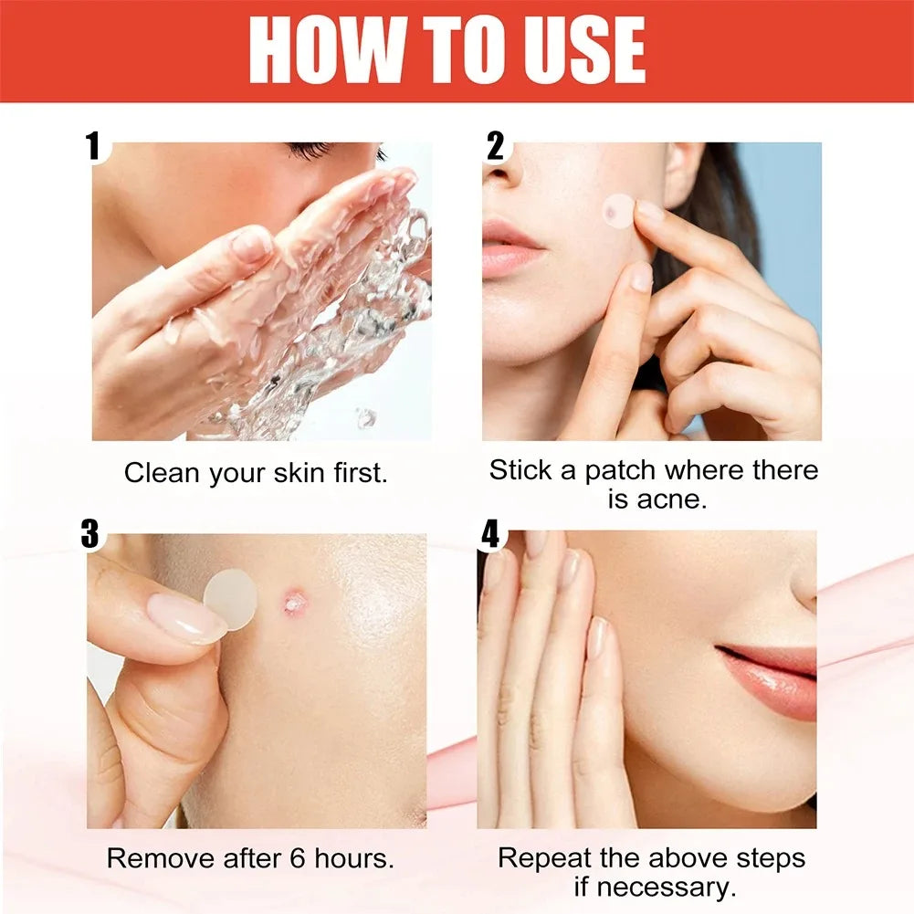240pcs Star Acne Patches Invisible Pimple Cover for Face Oil Control Spot Treatment